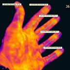 Eine (meine) ;-) linke Hand. So sieht bei normaler Raumtemperatur die Temperaturverteilung einer gesunden Hand aus. Gewisse (aber natürlich bei weitem nicht alle!) Erkrankungen manifestieren sich auch in der Wärmesignatur. So erscheinen beispielsweise Ent